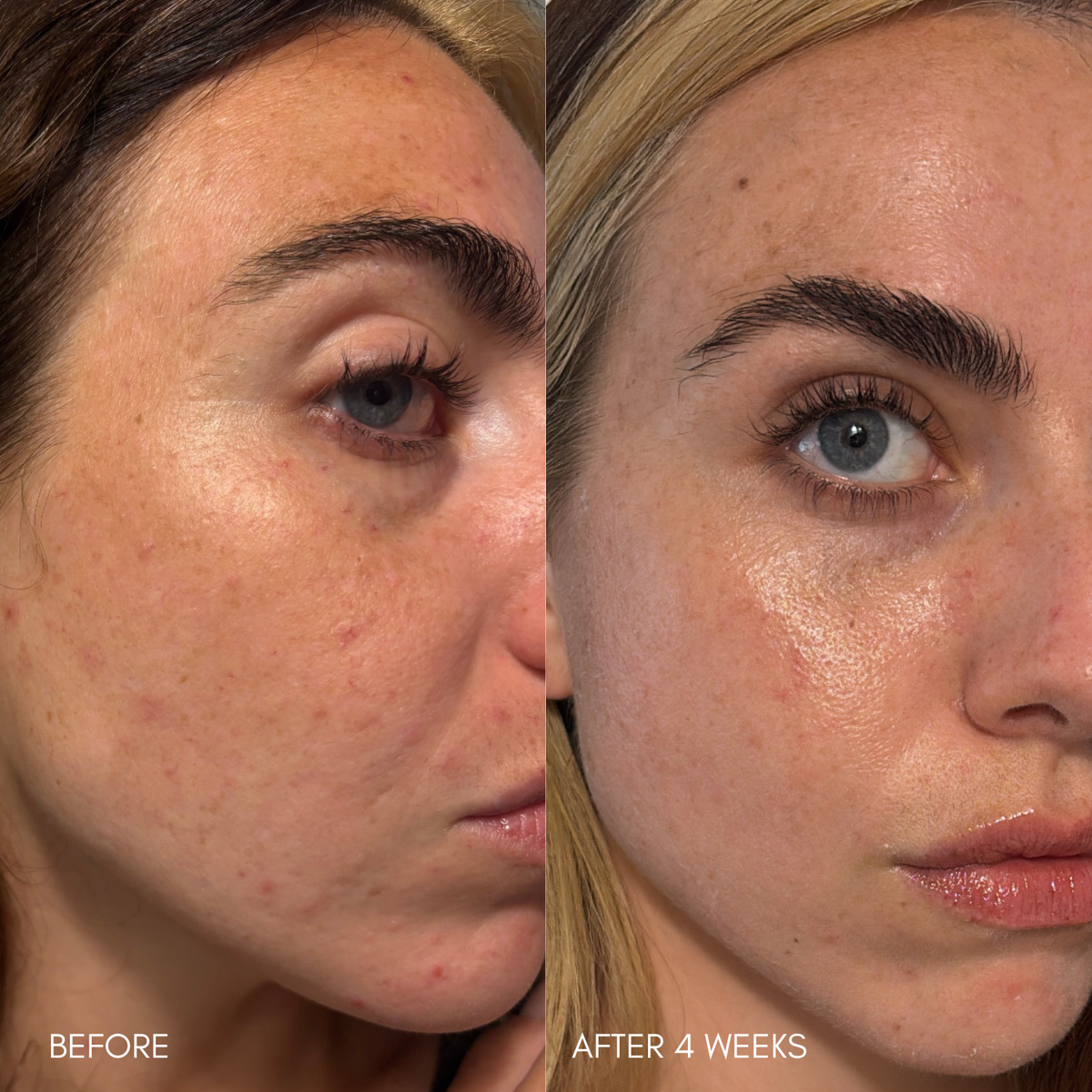 Clear + Even Skin System